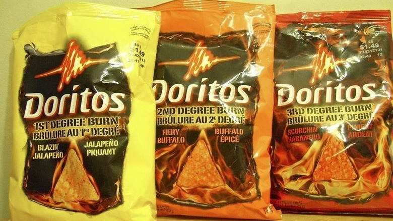 Bags of Doritos 1st Degree Burn