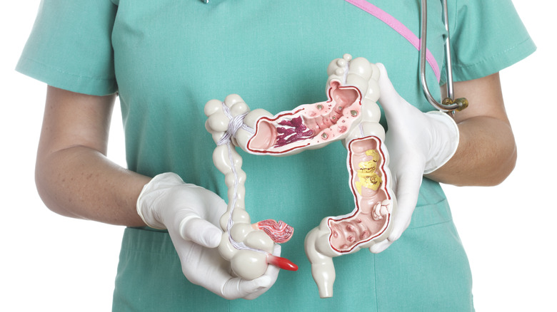 doctor holding digestive system model