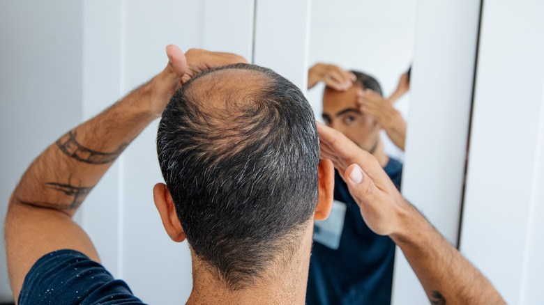 balding man at mirror