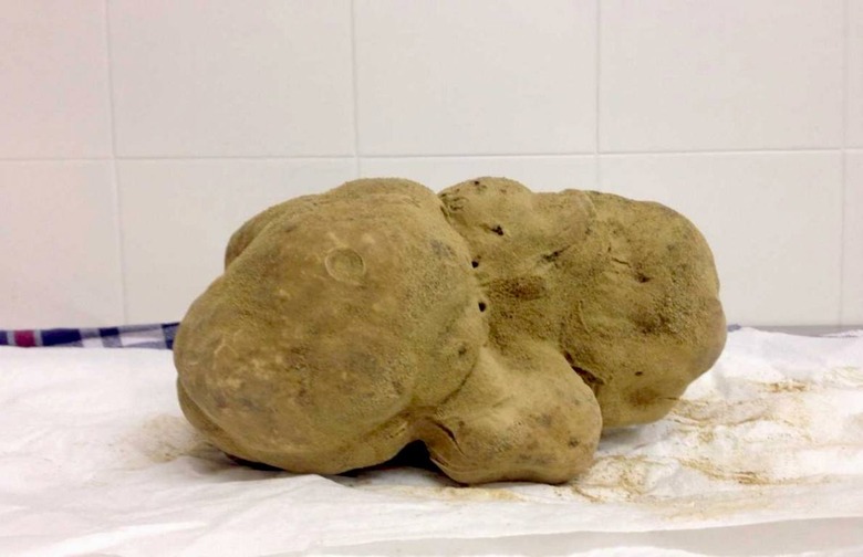 $61,250 White Truffle