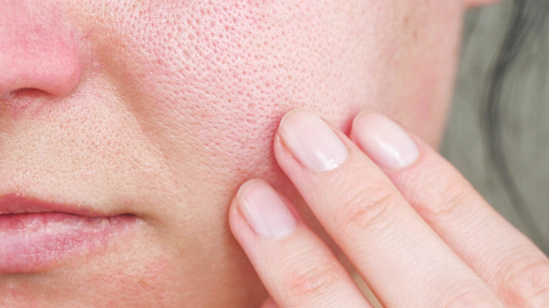 close up of woman's red skin