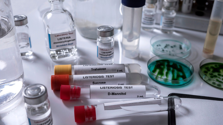 Listeriosis test tubes and cultures