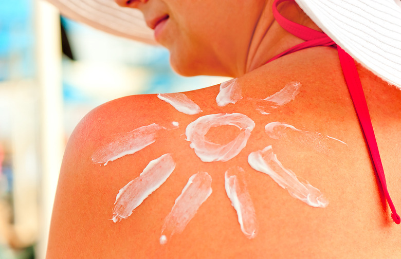 Not Treating Your Sunburn