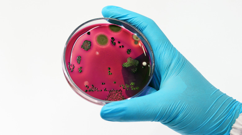 E.coli growing on petri dish